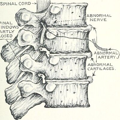 Recommendations on How to Keep Your Joints Healthy
