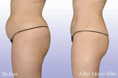 LASER HAIR REMOVAL AND MORE