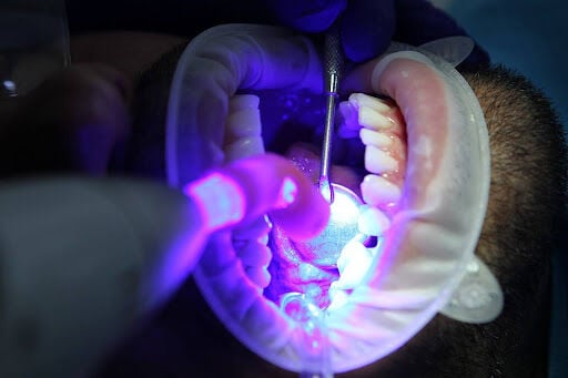 The Ultimate Guide to Oral Health: How to Keep Your Teeth and Gums Healthy
