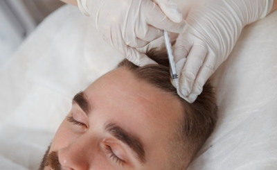 The Ultimate Medical Vacation: 5 Reasons Florida is The Premier Destination for Hair Restoration
