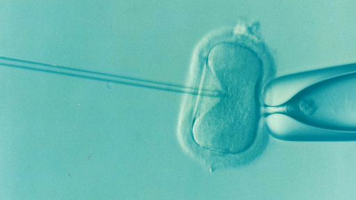 Why IVF May Be the Right Choice for You
