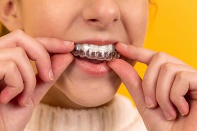 Things You Can Do to Get the Best Results from Braces