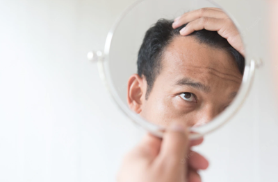 CBD_Oil_An_Effective_Way_to_Combat_Hair_Loss
