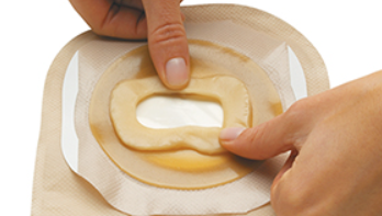 Why a Barrier Ring Is Essential for Secure and Comfortable Ostomy Care