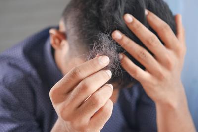 Hair loss comes in various forms, but is often a genetic condition