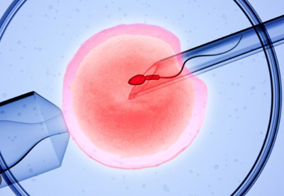 When and Why Doctors Recommend PGT During IVF Treatment