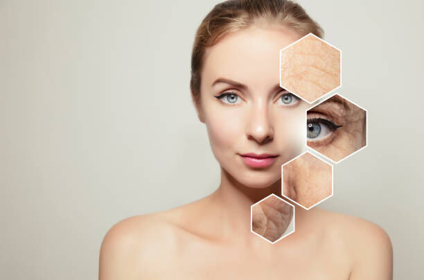 Common Myths About Botox Debunked
