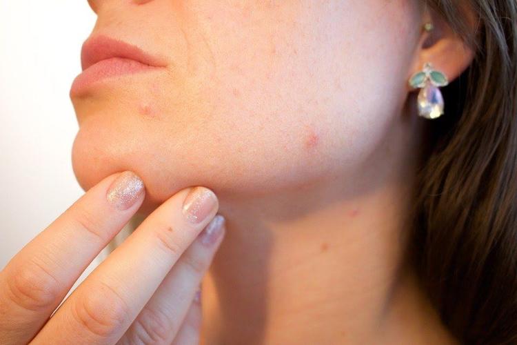 Tips in Making Your Skin Better and Improved