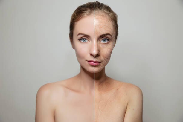 Common Myths About Botox Debunked