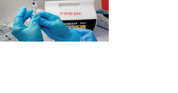 Florida infant confirmed to have monkeypox, the youngest in the state - Vimarsana News