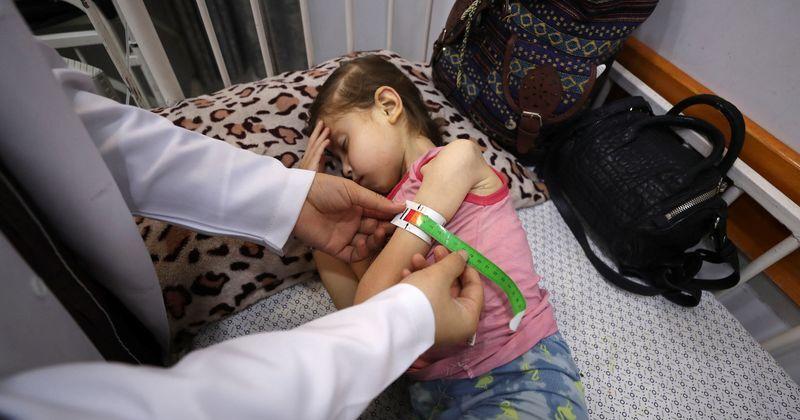 Gaza's hungry children slide towards starvation as emergency treatments dwindle