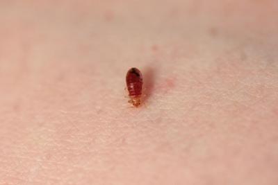 Bedbugs Put Bite On Springs Landlords Renters Colorado Springs News Gazette Com