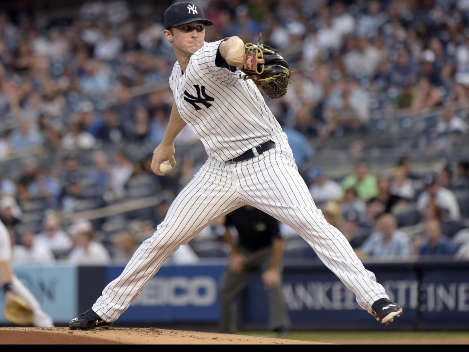 Yankees pitcher Bryan Mitchell hit in face by line drive, has