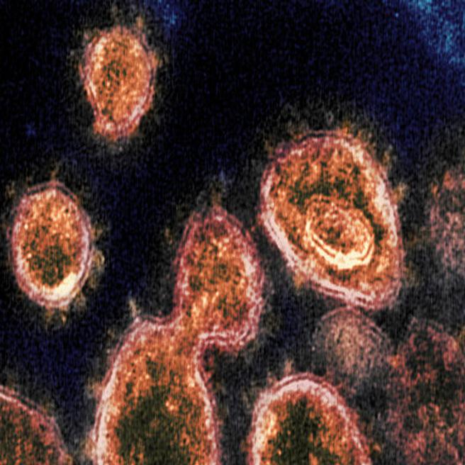 Coronavirus In Colorado And Around The World Latest Updates Colorado Springs News Gazette Com