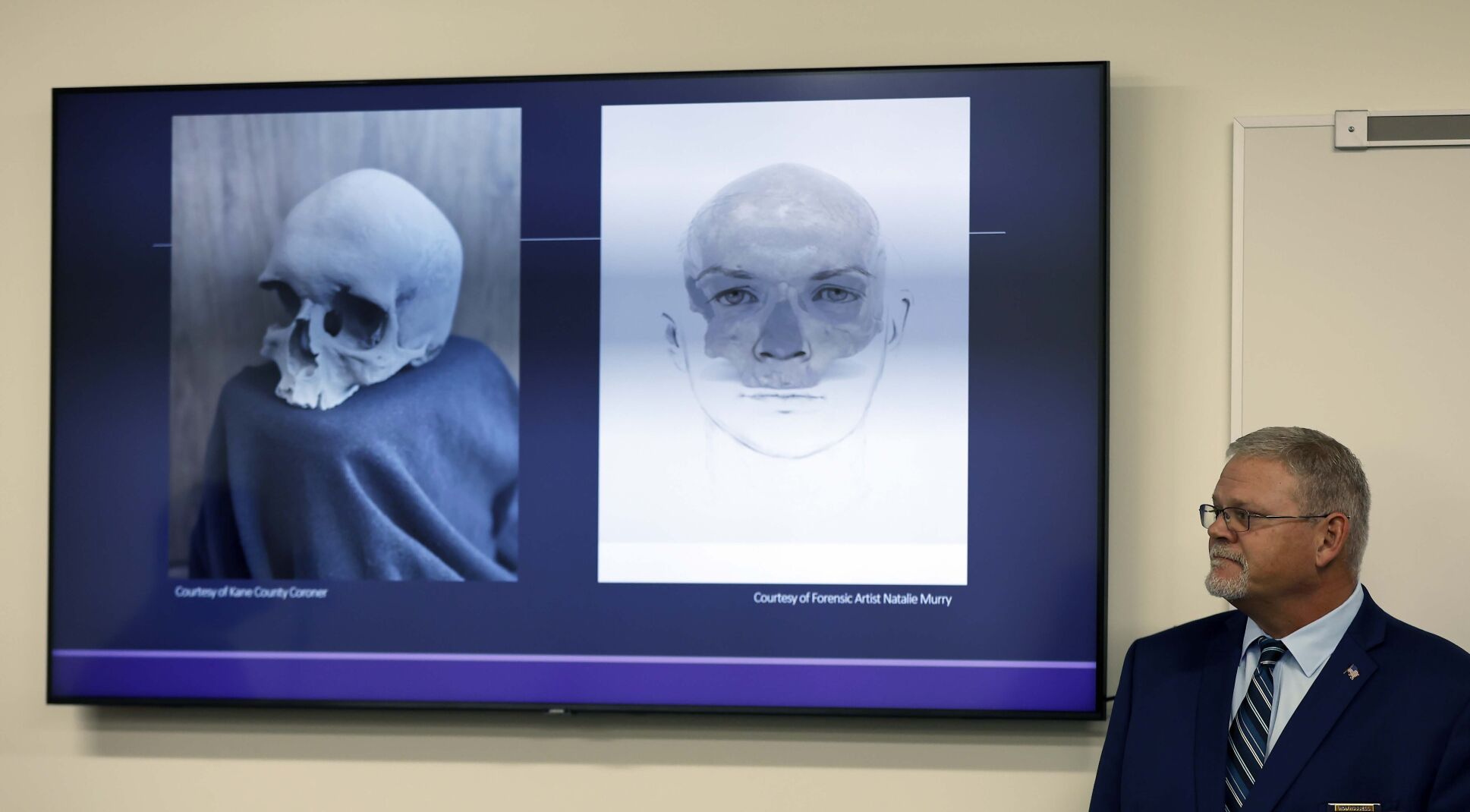 DNA Tests Identify 19th-century Teenager's Skull Found In Illinois Home ...