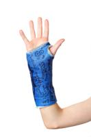 Broken Arm
