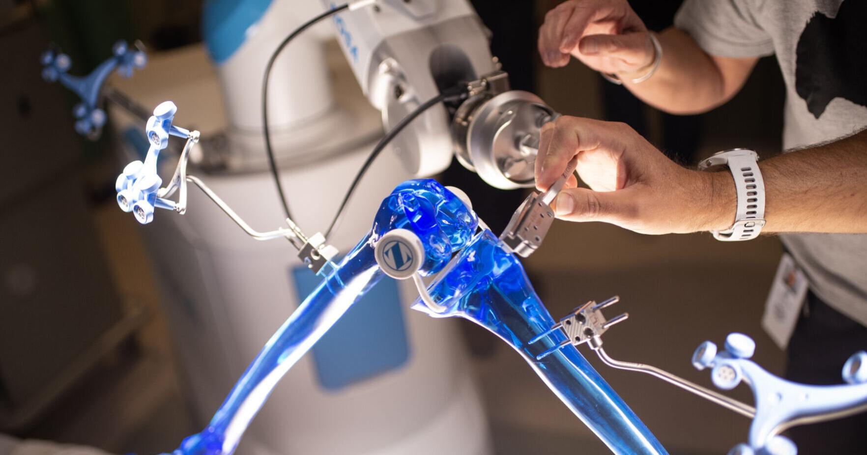 Surgery Robot - Vimarsana News