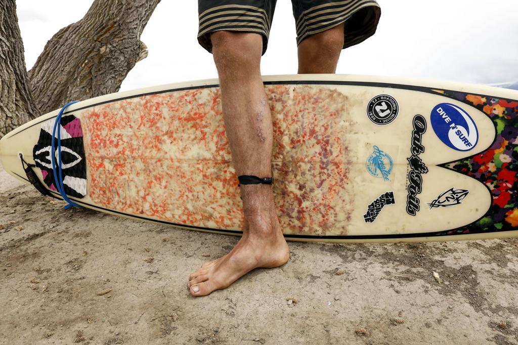 Shark Bite Is Man S Third Attack By Wild Animal Western Colorado Gjsentinel Com