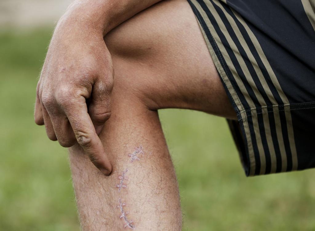 Shark Bite Is Man S Third Attack By Wild Animal Western Colorado Gjsentinel Com