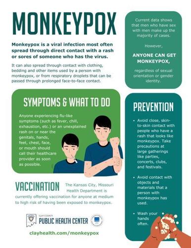 Monkeypox symptoms, prevention tips