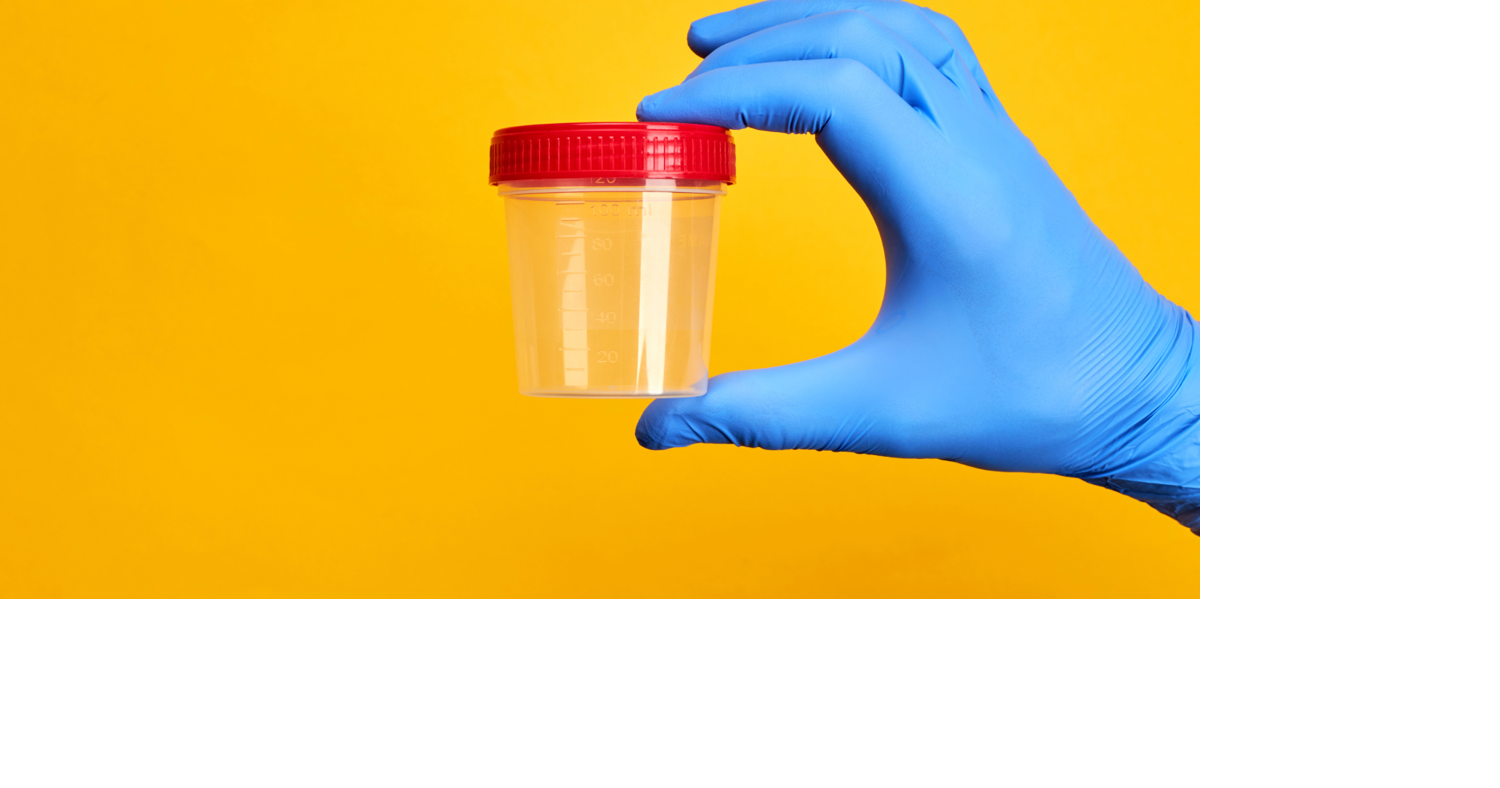 Random student drug testing proposal fails to advance in committee