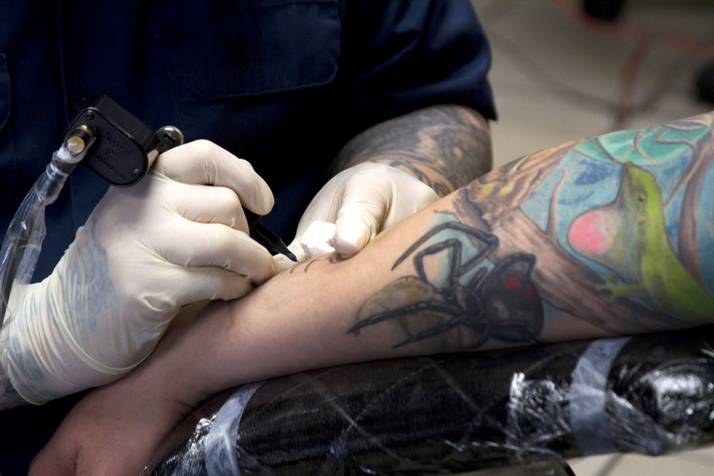 Tattoo Removal Laser Astanza Trinity in Mequon Wisconsin