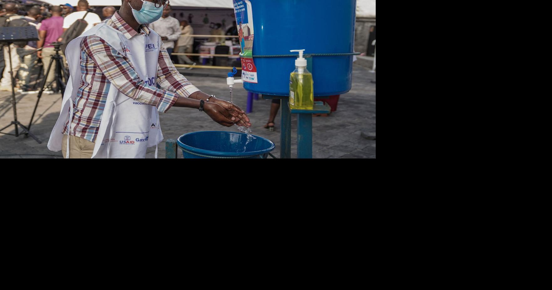 First US case of mpox variant reported in California | Health | gmtoday.com