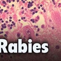Health department: Dog that bit Danville woman may have rabies | Local News