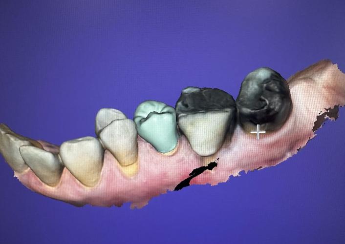 Laurens dentist office offers cutting edge technology News