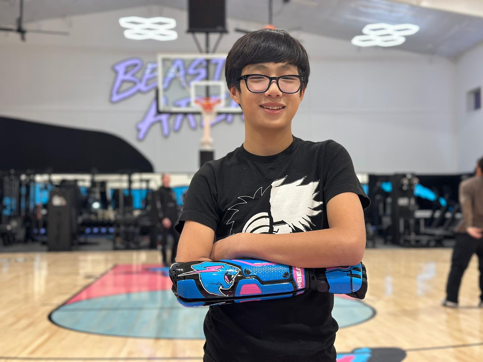 MrBeast surprises 12-year-old Texas boy with custom bionic arm ...