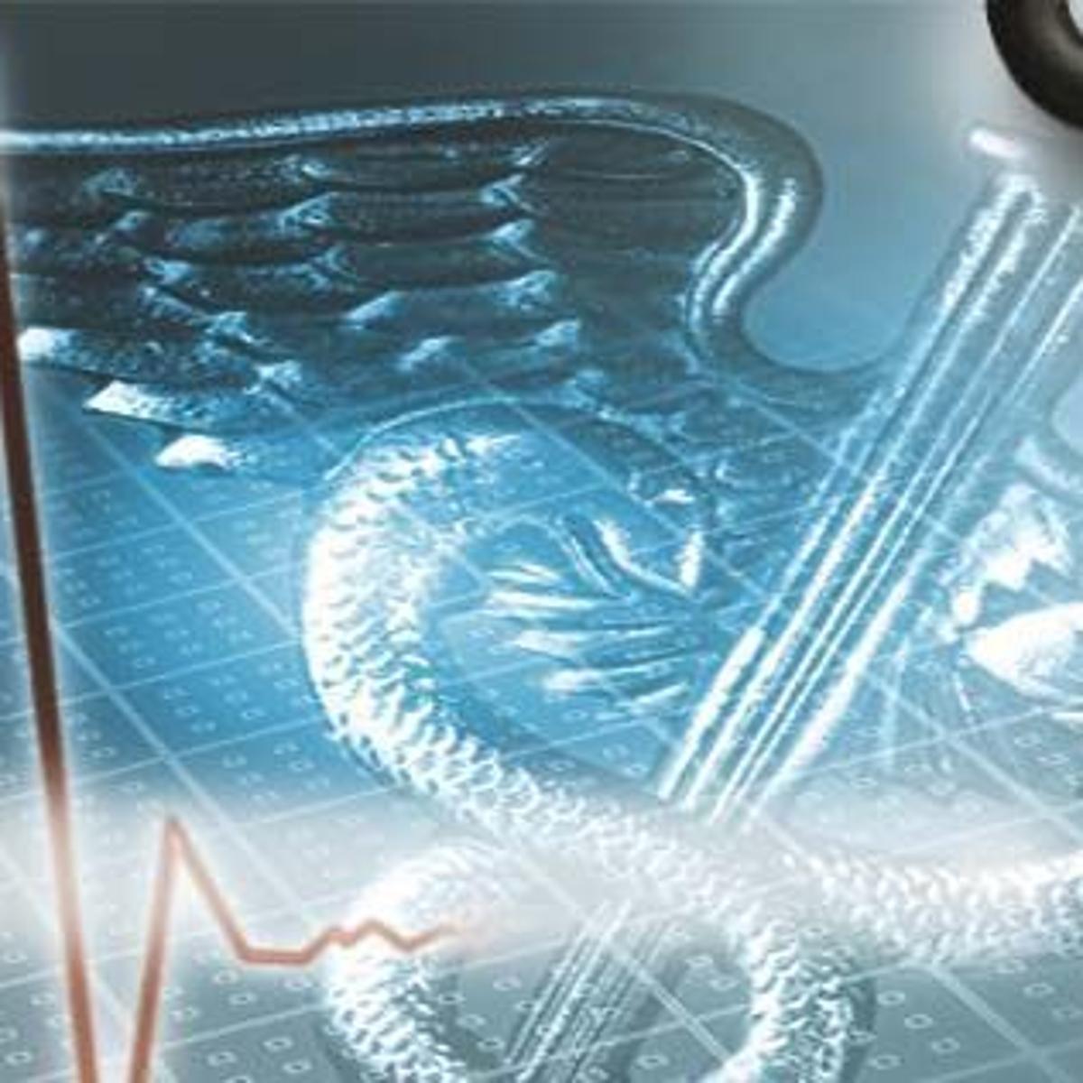 Tuberculosis Testing Underway For Olive Garden Employees In