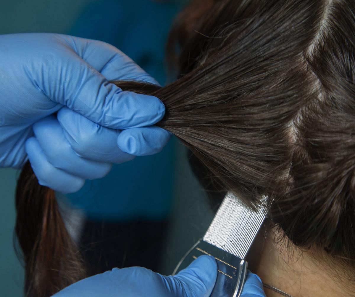 Super Lice Don T Panic Five Steps To Take Lifestyles