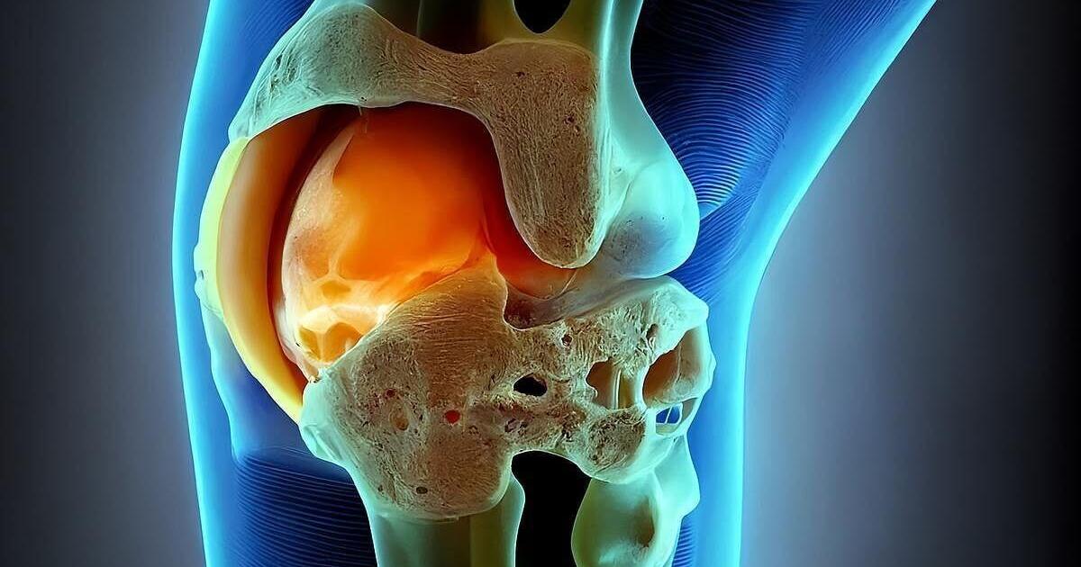 Fewer Opioids Needed After “Needle” Knee Surgery | Health