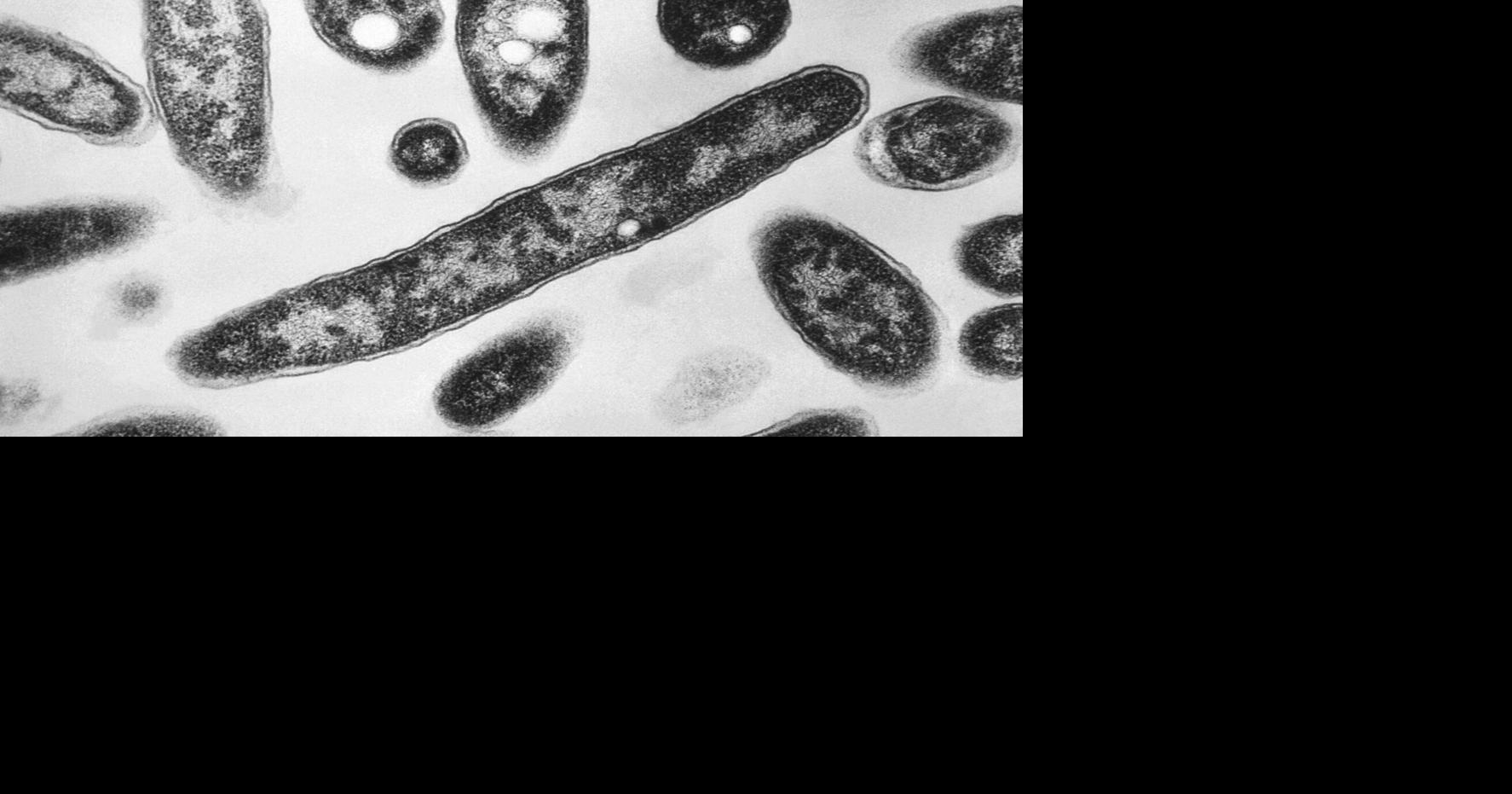 New cases slow in NYC Legionnaires' disease outbreak; Met museum among buildings with positive tests Health officials say a Legionnaires' disease outbreak in Manhattan's Upper East Side now counts 60 cases, but new diagnoses are slowing By JENNIFER PELTZ - Associated Press Jul 14, 2026 Jul 14, 2026 Updated 7 mins ago