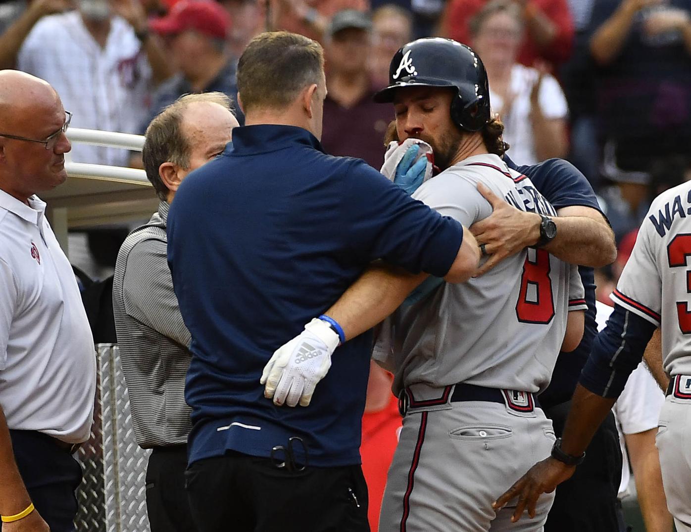 Braves' Charlie Culberson hospitalized after being struck in face, Sports
