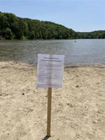 E. coli detected in water at Lake Vesuvius