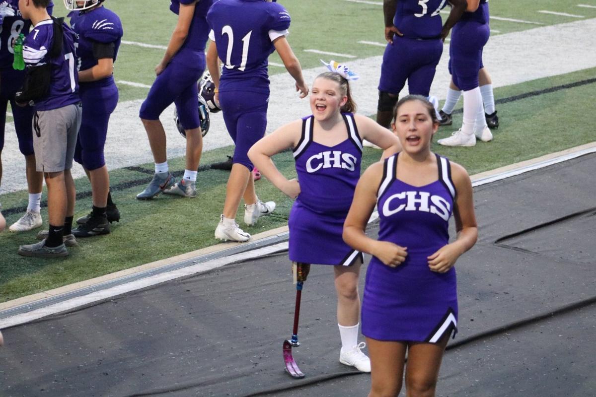Chesapeake Freshman Cheers Panthers On A Prosthetic Leg Sports Herald Dispatch Com