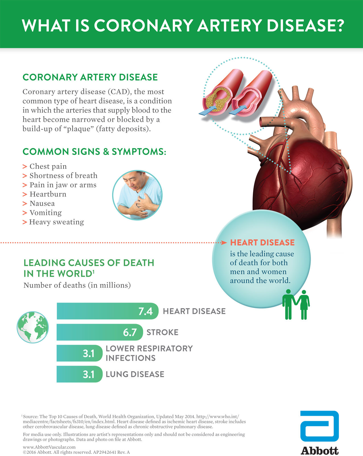 St. Mary’s Regional Heart Institute Advances Cardiology Service By ...