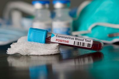 Second Person In Dane County Tests Positive For Coronavirus Covid 19 Hngnews Com