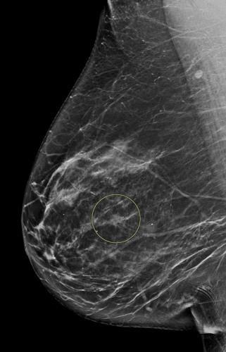 Understanding the vital role of diagnostic breast imaging | Health ...