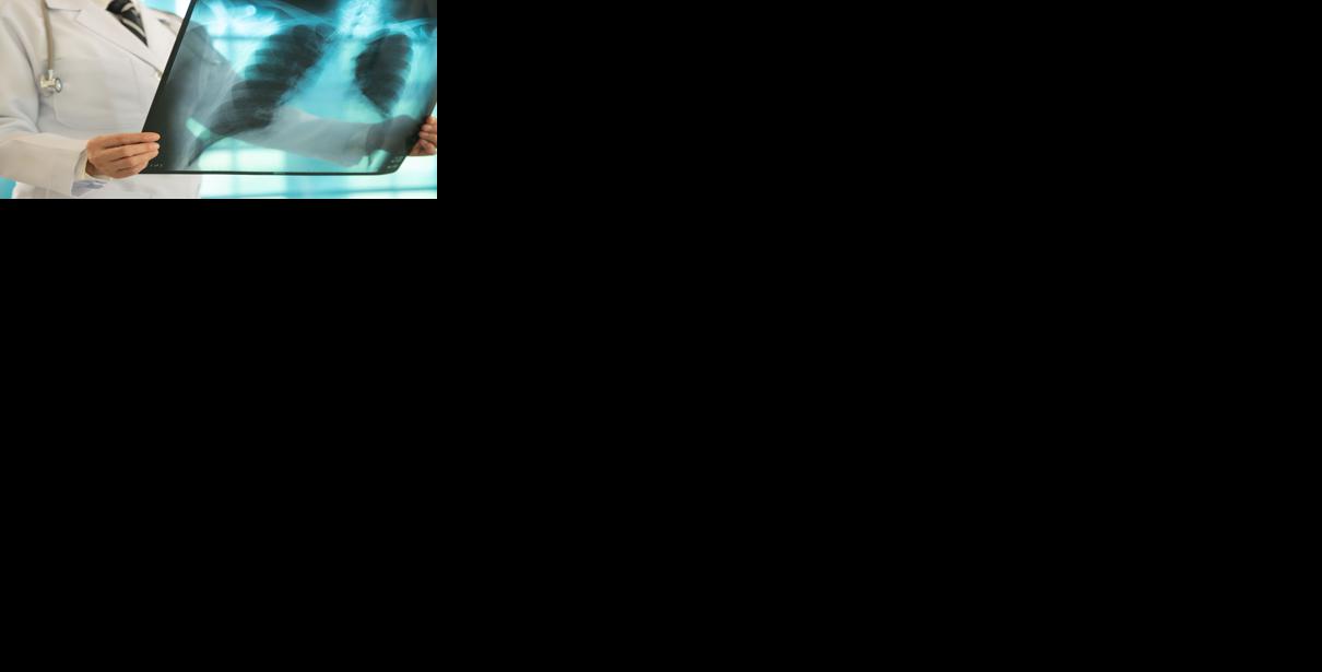 Doctor examining X-ray Generic