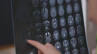 Brain scan file photo