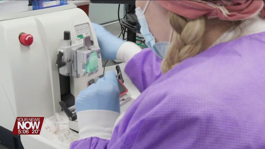 AI tools see beyond the human eye to better diagnose cancer