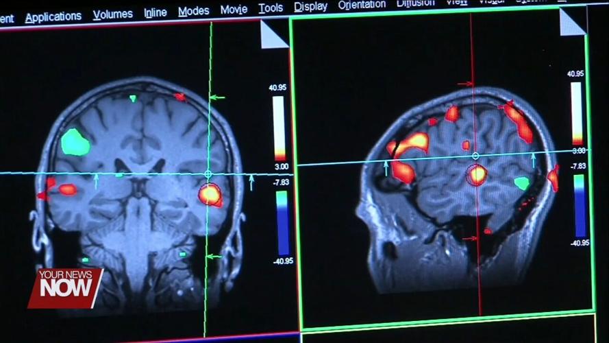 Why Multiple Sclerosis Can be Difficult to Diagnose