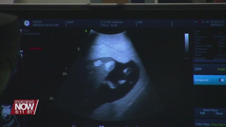 University of Findlay students learn with cuttingedge medical