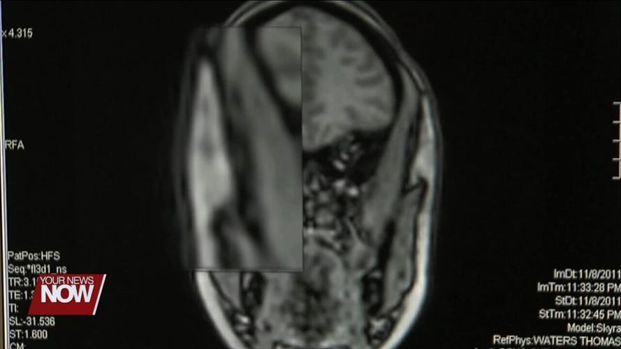 Many Adults Concerned about Brain Health but Not Seeking Help, Survey Finds
