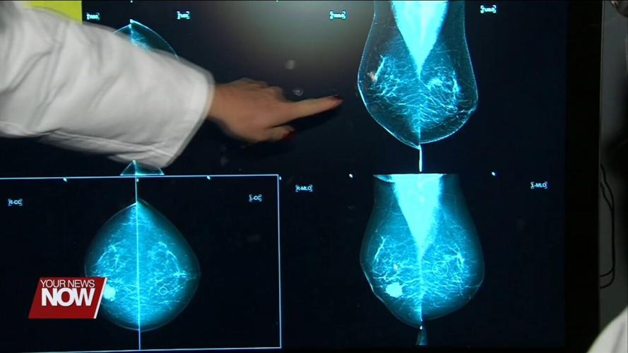 Changes Made to Breast Cancer Screening Guidelines