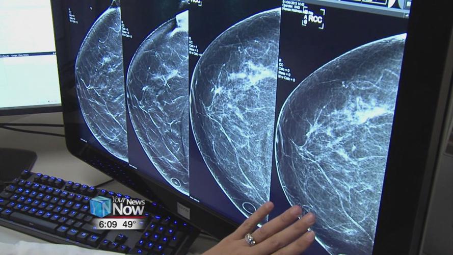 Local cancer survivor shares story