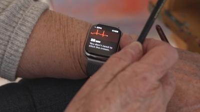 Survey: While most Americans use a device to monitor their heart, few share that data with their doctor