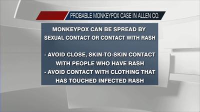 Probable case of monkeypox found in Allen County